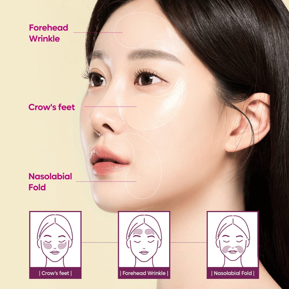 Modell mit Augenpatches, platziert bei Krähenfüßen, Stirn und nasolabialen Linien, die zeigen, wie Dr. Melaxin Cemenrete Calcium Volume Eye Patch für Falten und Volumenverlust verwendet werden kann.