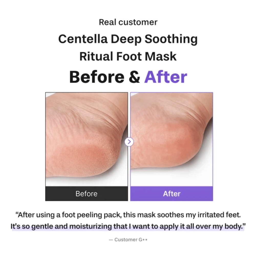 6. Baren Centella Deep Soothing Ritual Foot Mask – Vorher-Nachher-Bild, das eine weichere und besser mit Feuchtigkeit versorgte Ferse nach der Anwendung zeigt