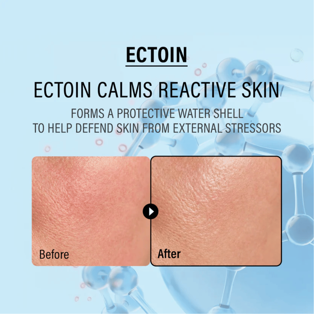 EPII Double Up Cream mit Ectoin, die empfindliche Haut beruhigt, vor äußeren Belastungen schützt und die natürliche Hautbarriere stärkt.