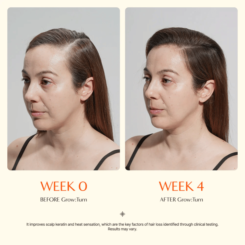 Vorher-Nachher-Bild einer Frau (Woche 0 vs. Woche 4), das eine verbesserte Haarqualität und ein volleres Gefühl nach der Anwendung zeigt.