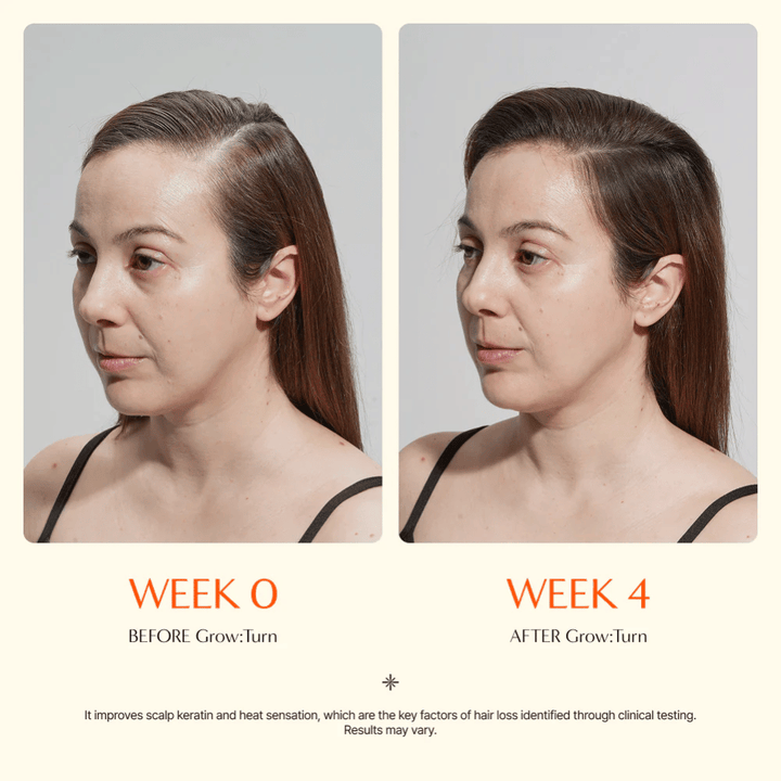 Vorher-Nachher-Bild einer Frau (Woche 0 vs. Woche 4), das eine verbesserte Haarqualität und ein volleres Gefühl nach der Anwendung zeigt.
