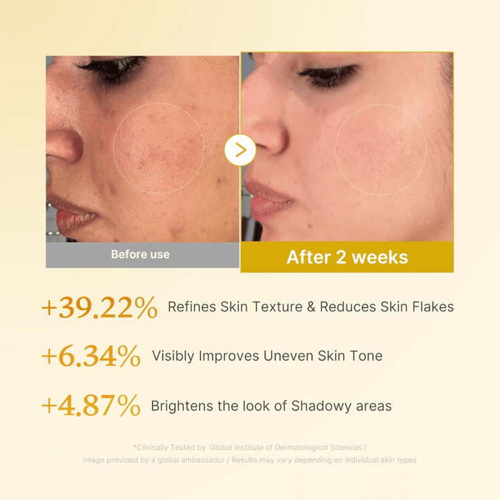 Vorher-Nachher-Bild für Medicube Kojic Acid Turmeric Resurfacing Toner, das eine verbesserte Hauttextur, einen ebenmäßigeren Hautton und verringerte trockene Hautschüppchen nach zwei Wochen Anwendung zeigt.