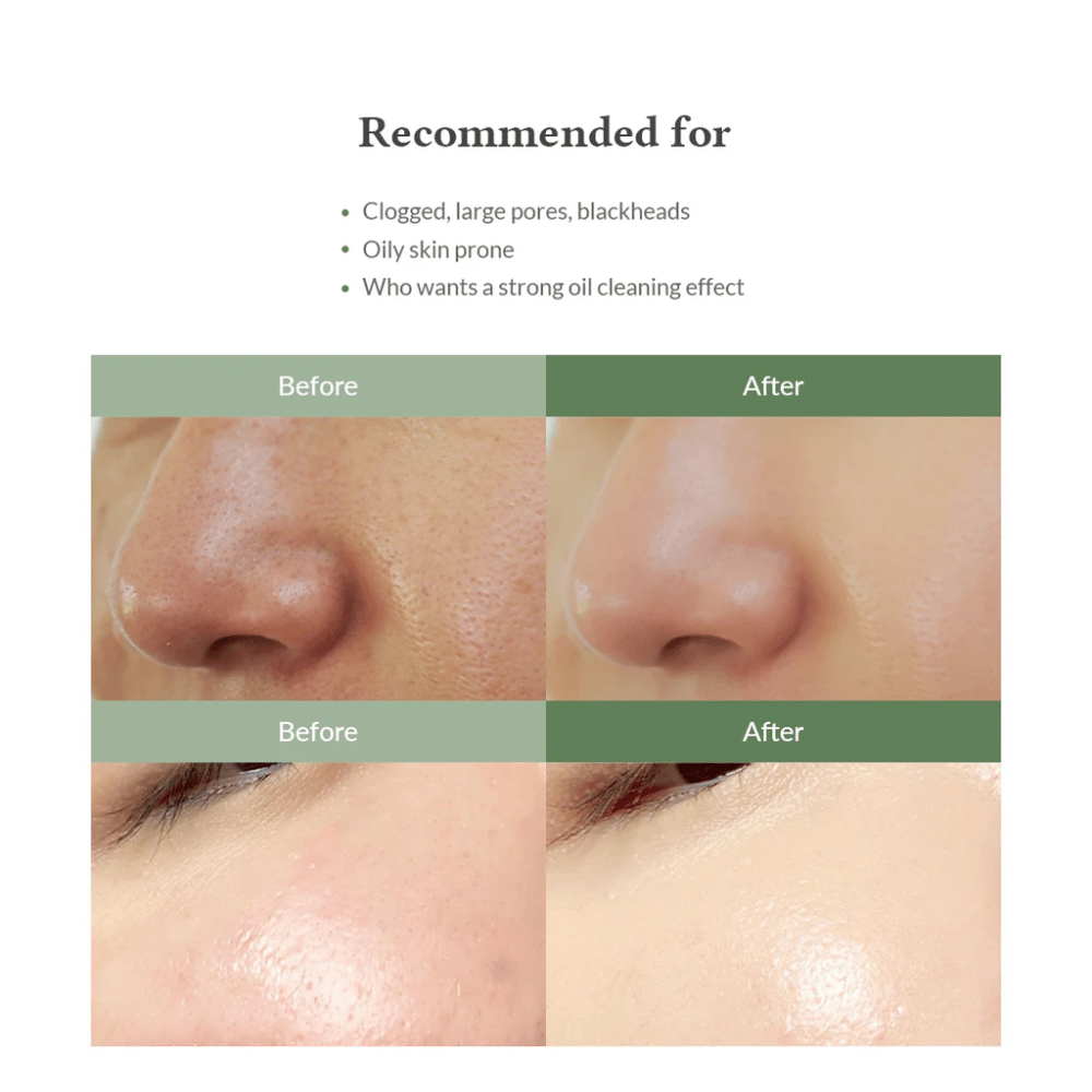 Dr. Althea Premium Quick Step Sebum Cleanser – Gesichtsreinigung, die hilft, Mitesser zu reduzieren, Poren tief zu reinigen und eine gleichmäßigere Hautstruktur zu bieten.