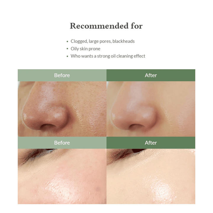 Dr. Althea Premium Quick Step Sebum Cleanser – Gesichtsreinigung, die hilft, Mitesser zu reduzieren, Poren tief zu reinigen und eine gleichmäßigere Hautstruktur zu bieten.